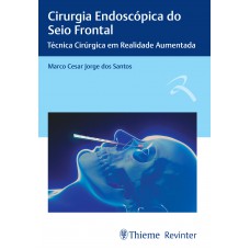 Cirurgia Endoscópica do Seio Frontal