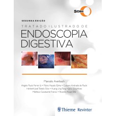 SOBED Tratado Ilustrado de Endoscopia Digestiva