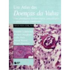 Atlas de doenças da vulva