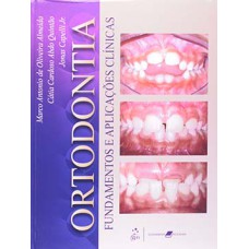 Ortodontia Fundamentos e Aplicações Clínicas