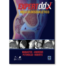 Expertddx Musculoesqueletico