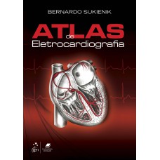 Atlas de Eletrocardiografia