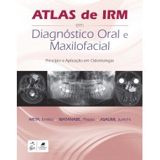 Atlas de IRM em Diagnóstico Oral e Maxilofacial
