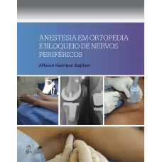 Anestesia em Ortopedia e Bloqueio de Nervos Periféricos