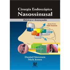 Cirurgia Endoscópica Nasossinusal