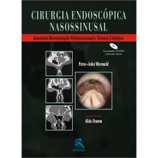 Cirurgia Endoscopica Nasossinusal