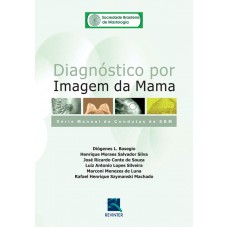 SBM Diagnóstico por Imagem da Mama