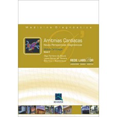 Arritmias cardíacas