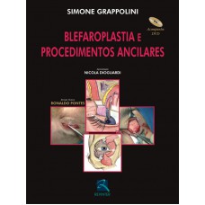 Blefaroplastia e Procedimentos Ancilares
