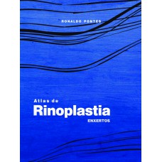 Atlas de Rinoplastia