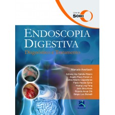 SOBED Endoscopia Digestiva