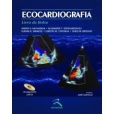 Ecocardiografia