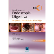 SOBED Atualização em Endoscopia Digestiva - Volume 2