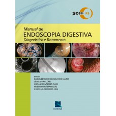SOBED Manual de Endoscopia Digestiva