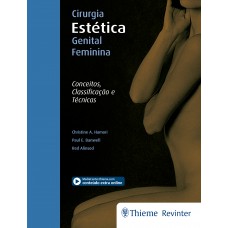 Cirurgia Estética Genital Feminina