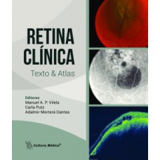 Retina clínica