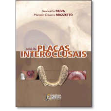 Atlas De Placas Interoclusais