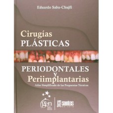 Cirugias Plasticas Periodontales y Periimplantarias-Atlas Simplificado de las Propuestas Tecn.