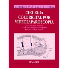 Cirurgia Colorretal por Videolaparoscopia