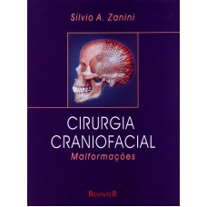 Cirurgia Craniofacial