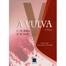 A Vulva
