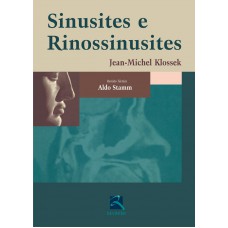 Sinusites e Rinossinusites