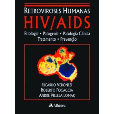 Retroviroses humanas HIV/AIDS